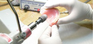 denture repairs and relines 